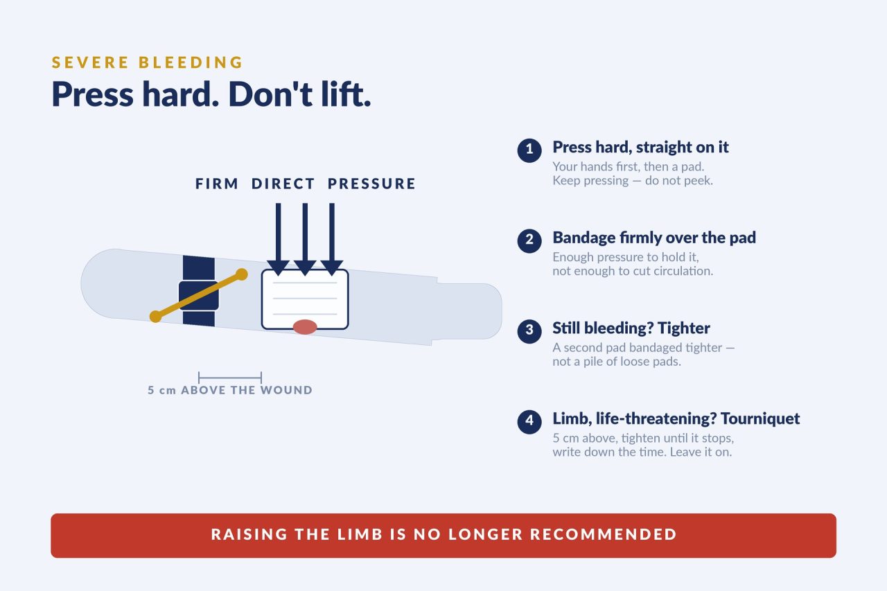 Diagram of severe bleeding first aid: firm direct pressure on a dressing over a forearm wound, with an arterial tourniquet applied 5 cm above it