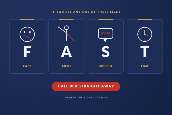 The four signs of stroke in the FAST test: face drooping, arm weakness, slurred speech, and time to call Triple Zero